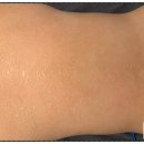 나예뷰티 | 대전 내동 체형관리 고주파관리 나예뷰티 바디케어