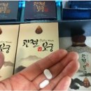 관절보궁