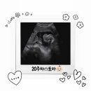 맑음내과의원 | 벌써 임신중기! 20주ꔛ태동˚✧₊⁎(feat.대구 더블유여성병원, 임산부 국가무료건강검진)