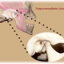 우리전통수기치료중 - 턱관절(TMJ, temporomandibular joint)이상을 올려봅니다. 이미지