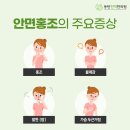 달아오름 이미지
