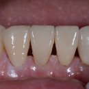 수치과기공소 이미지