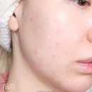 ㈜대세엠.케어 | 토리든 신상! 셀메이징 비타C 브라이트닝 캡슐 패치 1주일 써본 피부 미백 잡티케어 후기