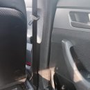 연세대학교치과대학치과병원 | 신촌 세브란스 연세대학교 치과대학병원 점액 낭종 제거