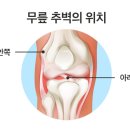 [운동/건강]추미애 장관 아들의 ‘무릎 추벽증후군’ 어떤 병? 스피드 이상화 선수는?(2020.09.08) 이미지