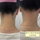 스킨리에 | 대구 수성구 왁싱샵 헤어라인 뒷목 왁싱 후기 스킨리에