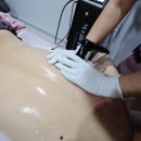 핑크멍 | 포항 북구 피부관리, 핑크뷰티에서 고주파 등관리 후기