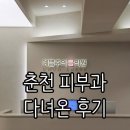 바른피부과의원 | 춘천피부과 예쁨주의 쁨의원 셀르디엠, 리프팅,쥐젖, 기미,내돈내산 후기