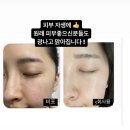 최대 85%할인율!! all self care 9주년 대기획전 스타터! 오픈 !