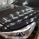 소사덴트 이미지