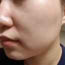 큐어텍 이미지