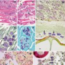 Zebrafish의 미포자충 Pleistophora hyphessobrynconis 이미지
