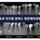 평촌예치과병원 이미지