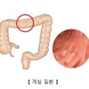 대장게실 이미지