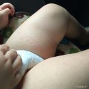 황소아과의원 이미지