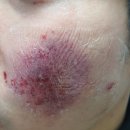 압구정리치모아의원 이미지