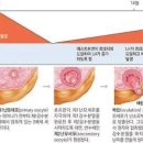 배란기 배란혈 배란통 시기임신확률 이미지