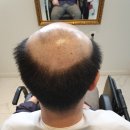 제천가발 이미지
