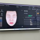 11305-15-400-1 | 강남역 울쎄라피프라임 효과, 통증 등 400샷으로 얼굴윤곽 관리한 후기