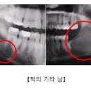 낭 - 제주시 우령2길 52 | 낭