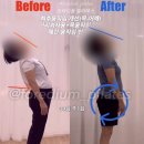 웰니스 케어 365모란센터 | 걸을 때마다 허리가 아파요" 30회 맞춤 레슨으로 되찾은 일상과 여행 (체형교정/통증완화 리얼 후기)