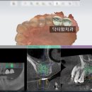 닥터함치과의원 | 인천 서구 신현동 석남동 가정동 디지털 임플란트, 닥터함치과