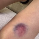 둔산성모정형외과의원 이미지