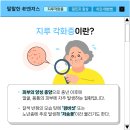 누구나 겪을 수 있는 지루 각화증 이미지