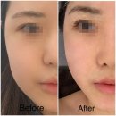 연산백련로 1번길 16-5 보릿고개 건너편 | 예라인에스테틱 목포점에서 웨딩 5G 윤곽관리받고 온 후기..💗