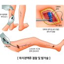 위대항맥외과의원 네이버블로그