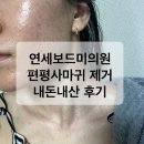 연세약국 | 연세보드미의원 편평사마귀 제거 후기 2 - 시술 당일, 일주일 후기, 10일차 후기