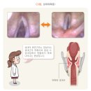쉼; 이미지