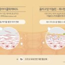 마인드워시