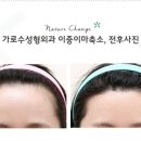 이마