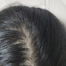 여성두피 고민 끝. 여름철 정수리 볼륨까지 챙긴 닥터본모 프로패셔널 헤어 세럼 사용 후기