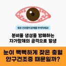 류마이준희내과의원 | 쇼그렌증후군 치료 병원 류마내과에서 불편함 해결!