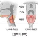 비인두암 vs 비부비동암 = 서로 같은 코에서 발생하는 악성종양의 암 이미지