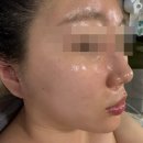 고운스킨케어 - 대덕구 | 전주 평화동 윤곽관리 / 고운스킨케어 에서 윤곽1회로 효과본 찐 후기 / 전주 체형관리 / 에스테틱 복부...
