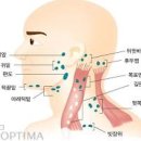 귀 뒤쪽 통증 원인 3가지 및 : 왼쪽 오른쪽 귀뒤 이미지