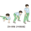 듀시엔형 근이영양증(Duchenne muscular dystrophy)근골격질환, 유전질환이란? 이미지