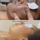 여신의발견 | (공장형X)오마카세 같은 케어 여신의발견 좁쌀여드름 후기