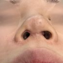 노즈랩의원 이미지