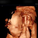 도안누리여성의원 이미지