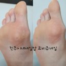 르비쥬네일 이미지