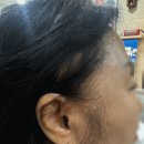 한미밧데리 | 용인보청기 비교하고 한미보청기로 결정한 이유와 방문 후기