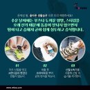 나도손톱 레푸스 개봉점 이미지