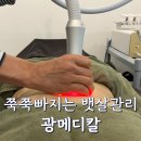 다이어트관리 광메디칼 뱃살 다이어트기기 체험 솔직후기
