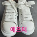 슈즈크리닝 | 알렉산더맥퀸 오버솔 명품 운동화 크리닝 세탁 평택 비포에프터 솔직후기