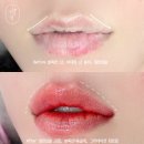 기반 입술컬러 디자인 후기 [송도 입술/말린입술 교정/검은입술 중화/입술 잘하는 곳/위닛뷰/위니드뷰티]