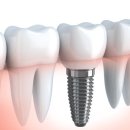 뉴욕디지털치과의원 이미지